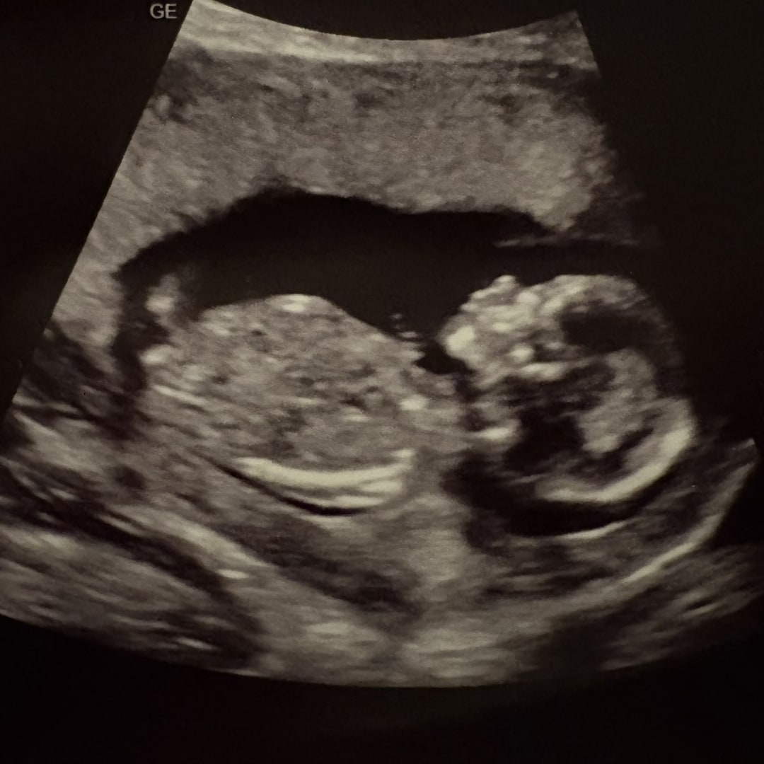 Photo shared by Margeaux for their Babylist baby registry.