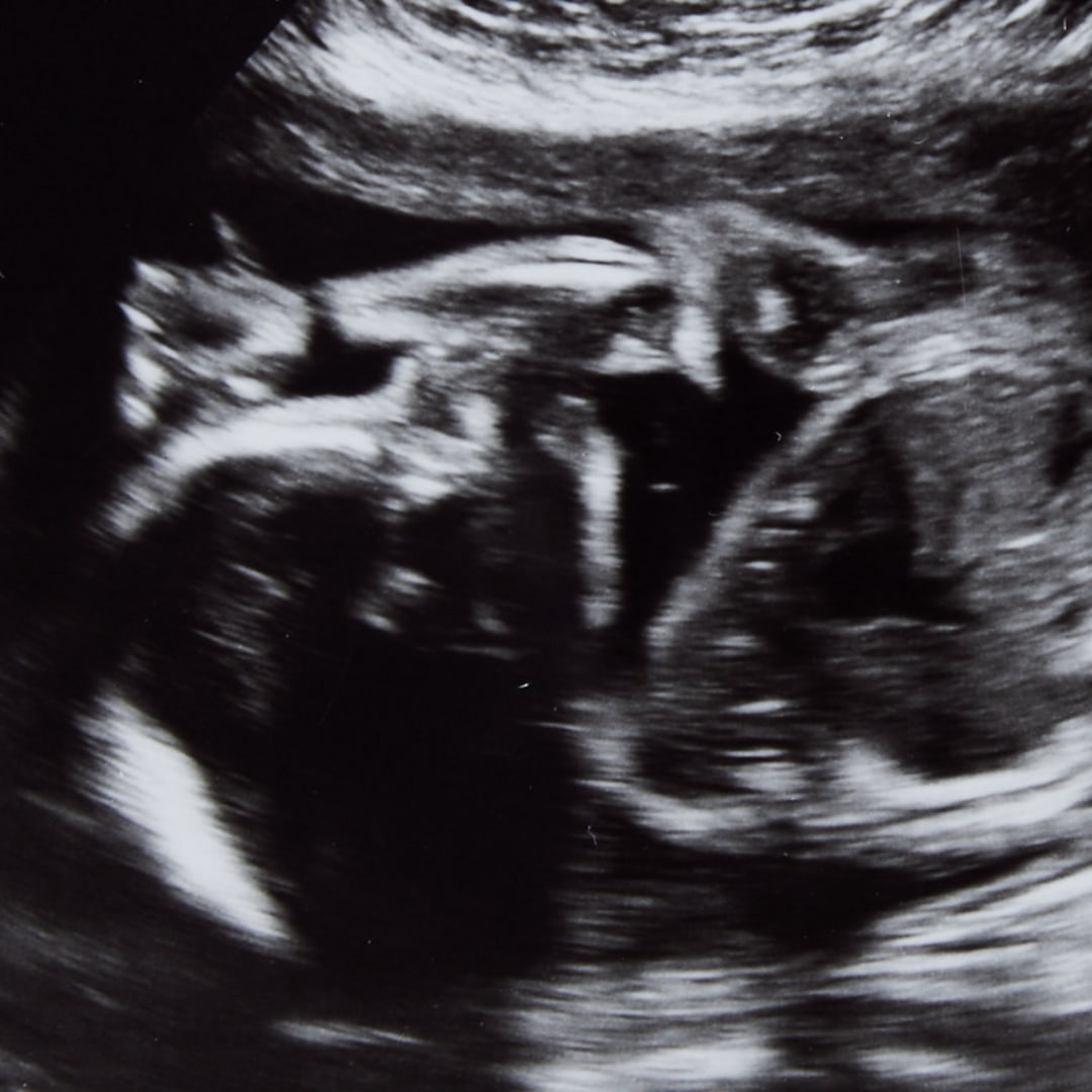 Photo shared by Rebeka for their Babylist baby registry.