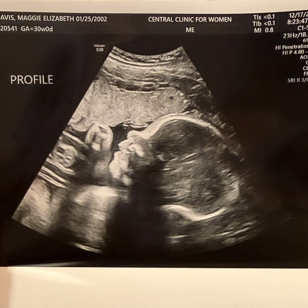 Photo shared by Maggie for their Babylist baby registry.