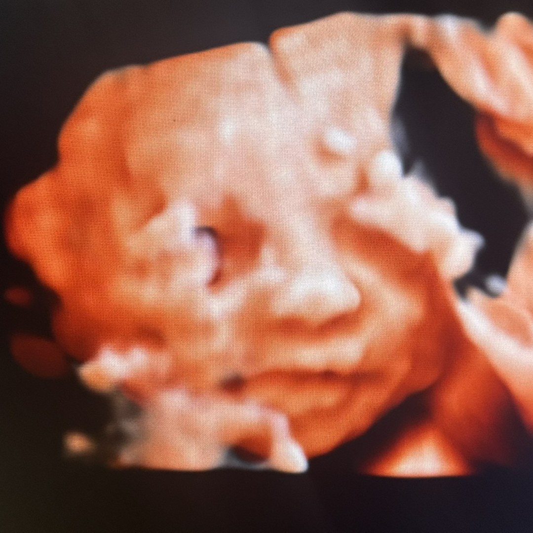 Photo shared by Ana Gabriela for their Babylist baby registry.
