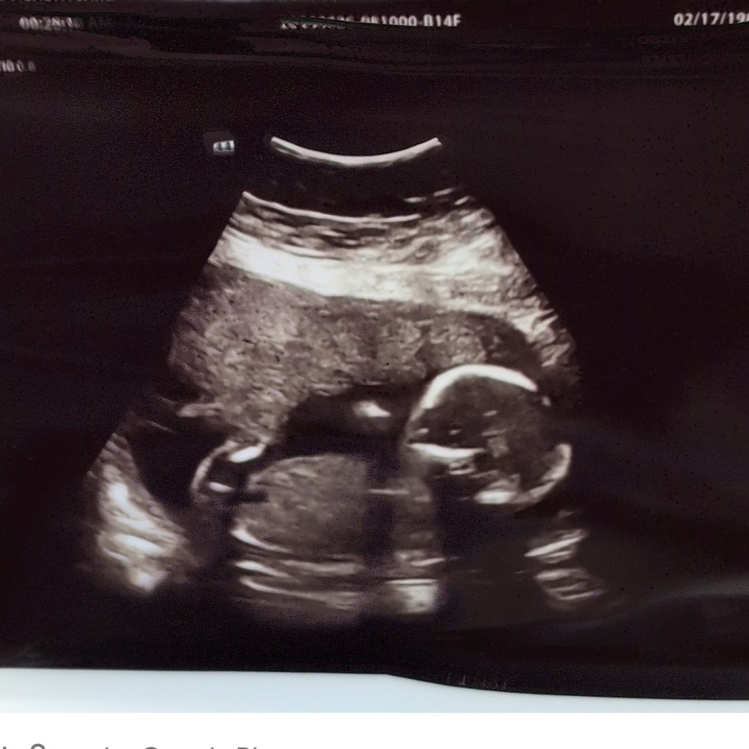 Photo shared by Sarah for their Babylist baby registry.