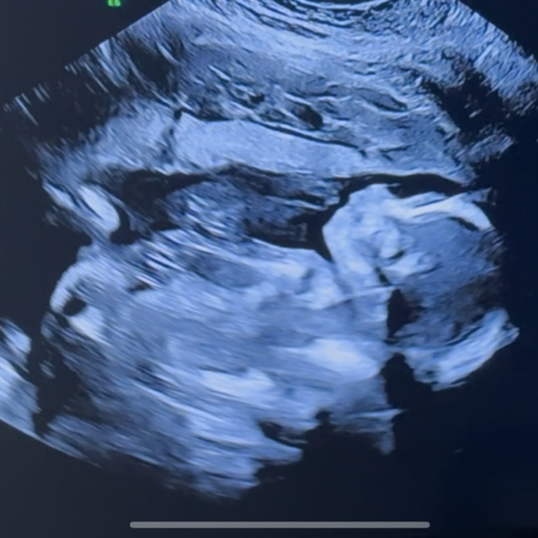 Photo shared by Allie for their Babylist baby registry.