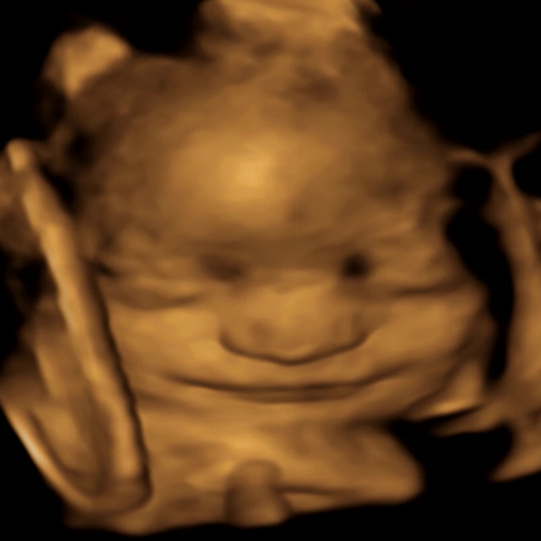 Photo shared by Dayana for their Babylist baby registry.