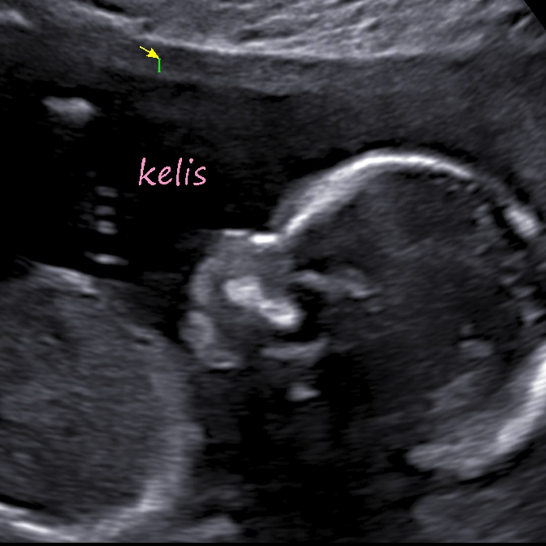 Photo shared by Kaira for their Babylist baby registry.