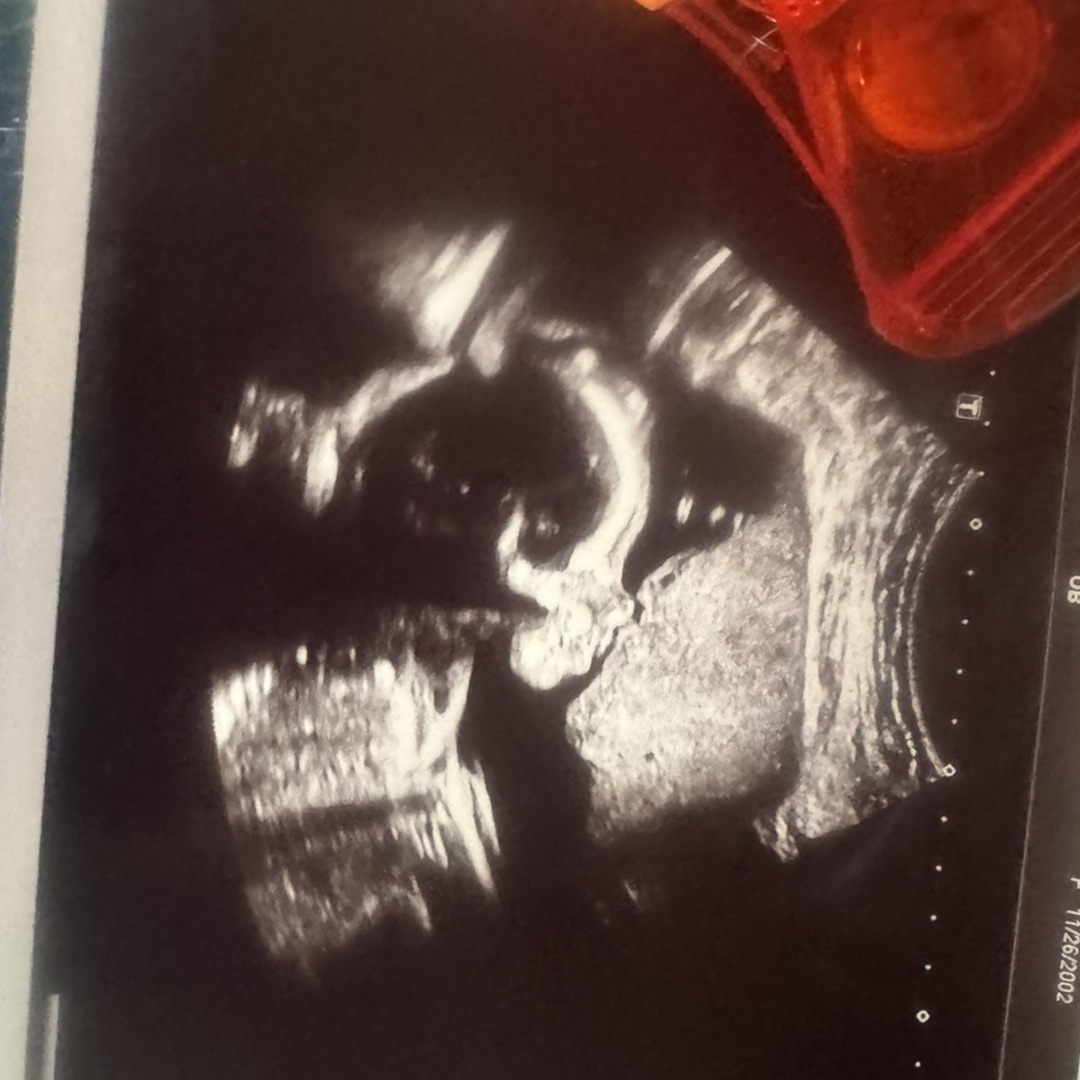 Photo shared by Sommer for their Babylist baby registry.