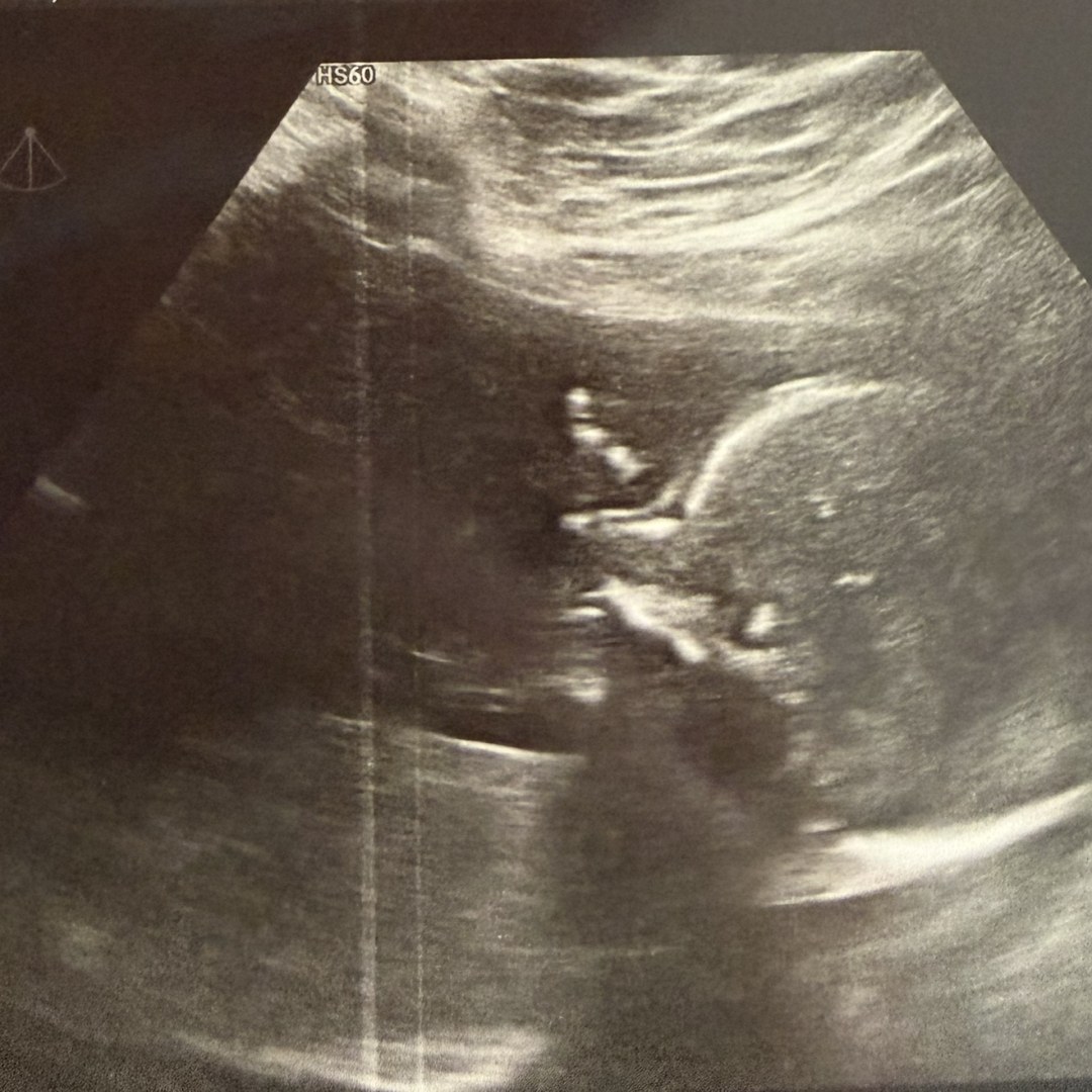 Photo shared by Giselle for their Babylist baby registry.