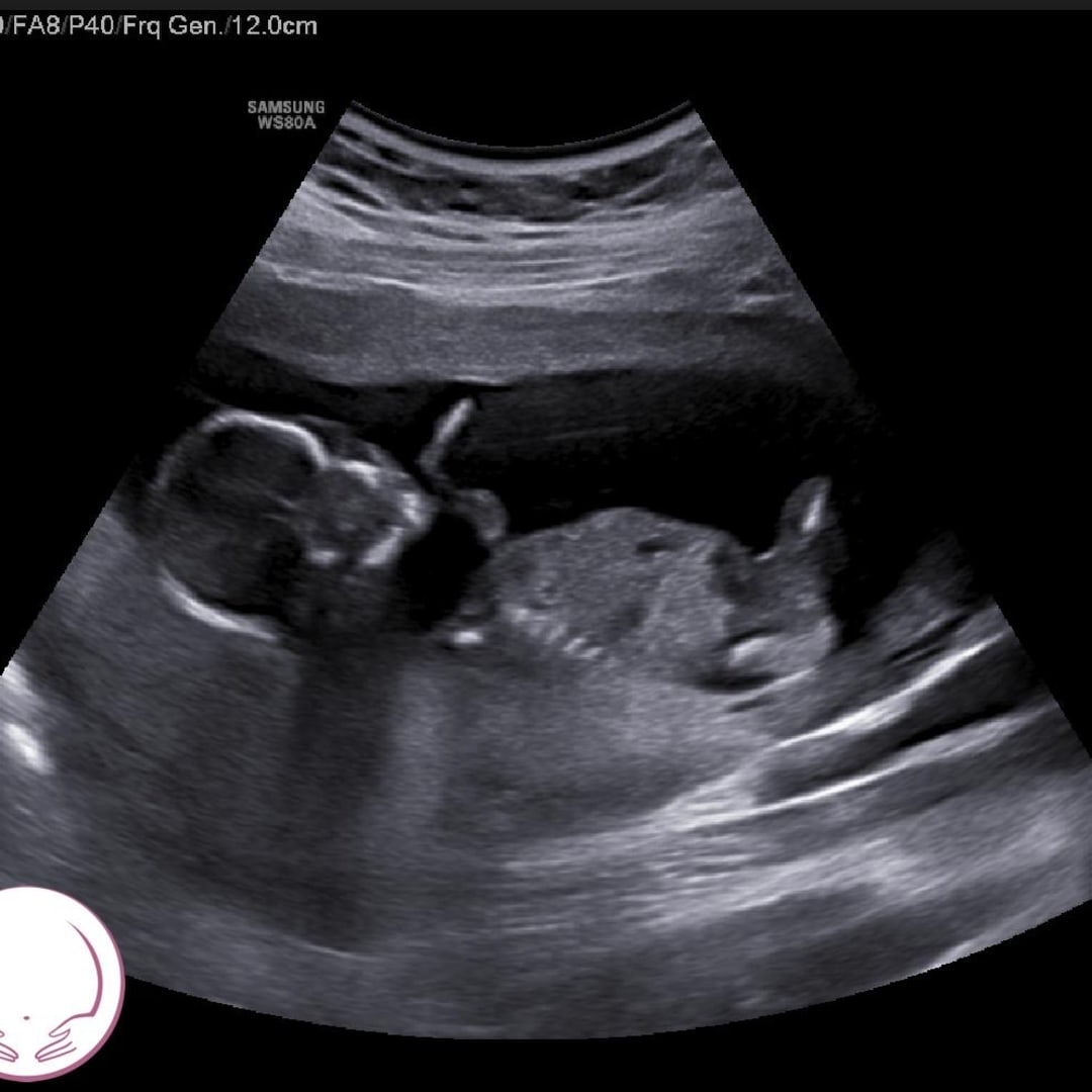 Photo shared by Hannah for their Babylist baby registry.