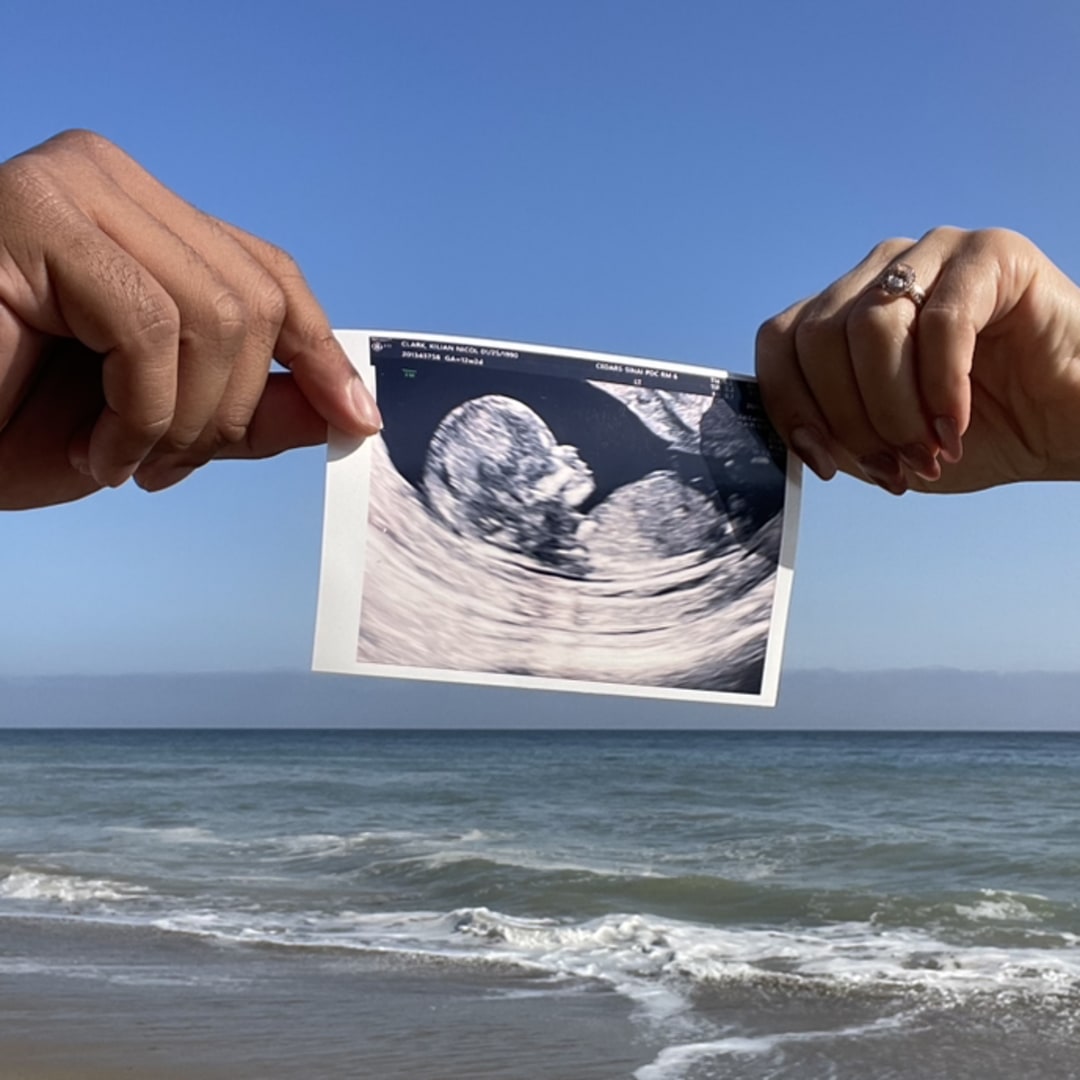 Photo shared by Kilian for their Babylist baby registry.