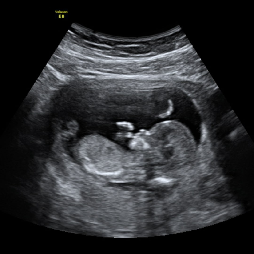 Photo shared by Sammi Jo for their Babylist baby registry.