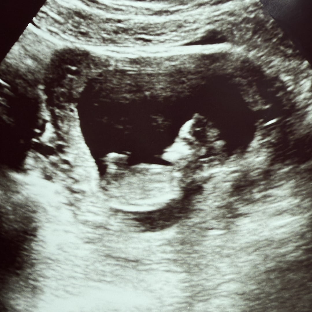 Photo shared by Piney & Andrew for their Babylist baby registry.
