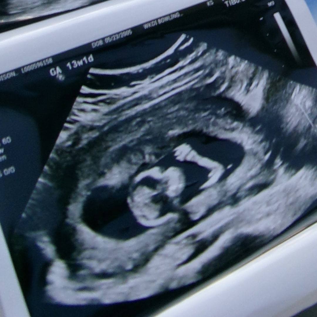 Photo shared by Madison for their Babylist baby registry.