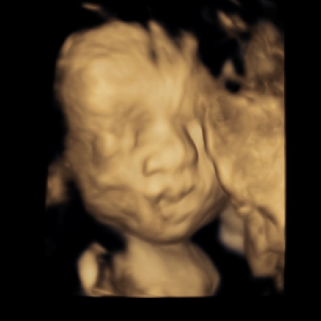 Photo shared by Caitlynne for their Babylist baby registry.