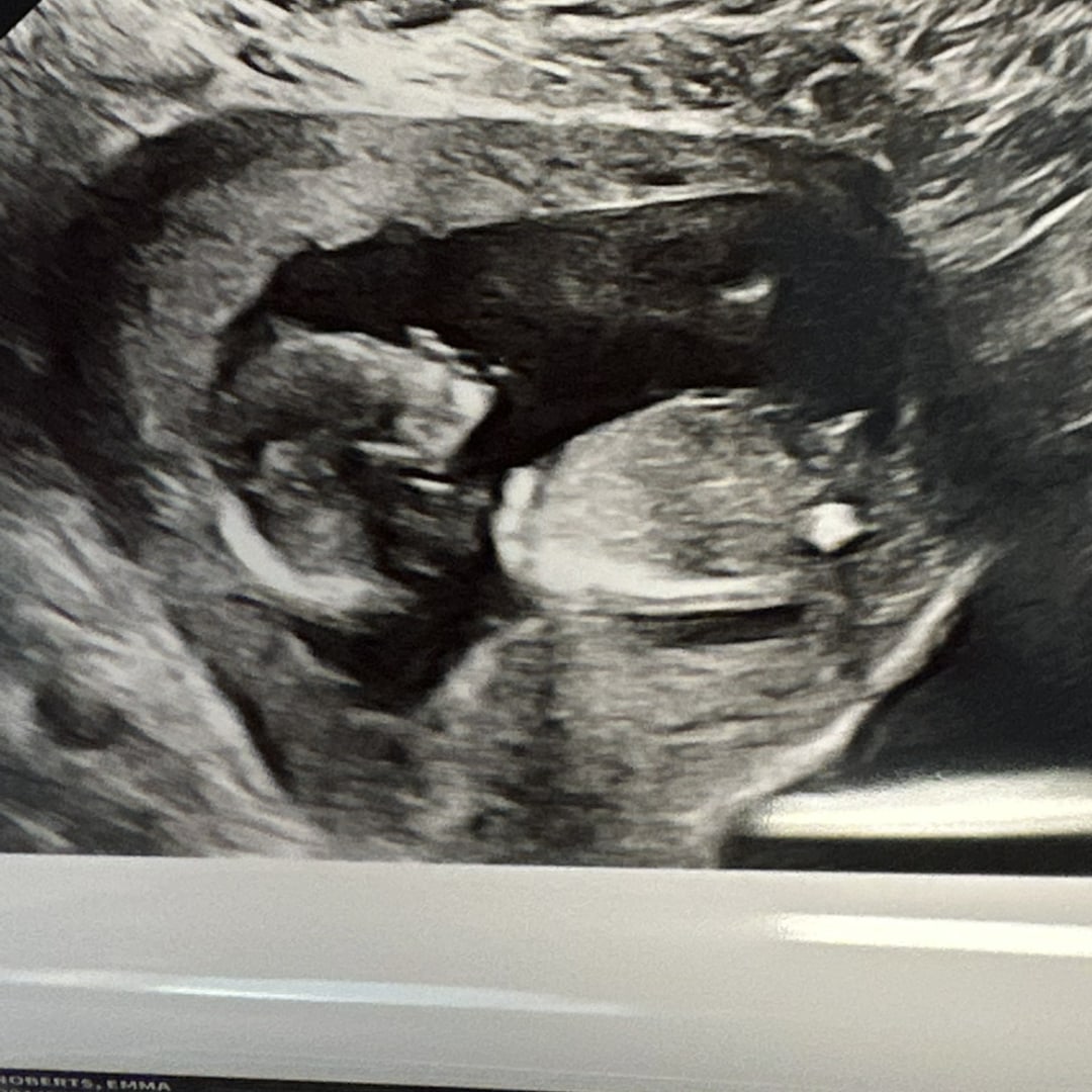 Photo shared by Emma for their Babylist baby registry.