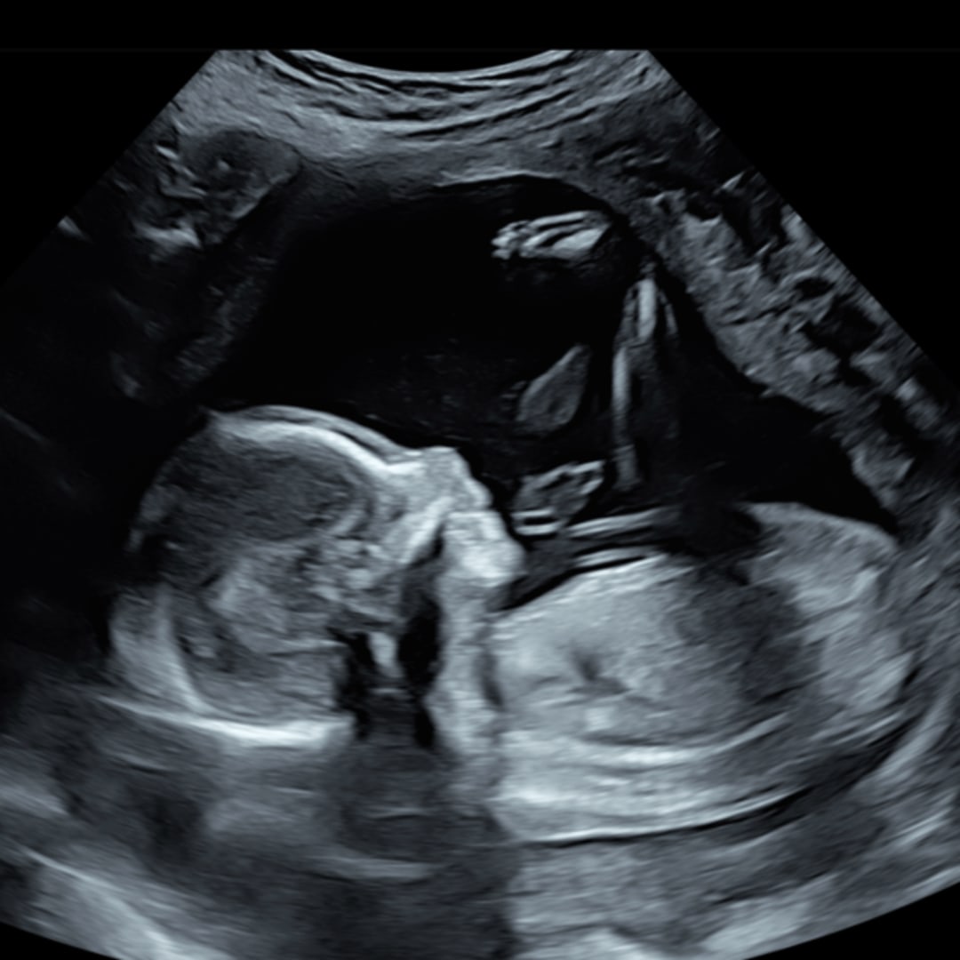 Photo shared by Shyla for their Babylist baby registry.