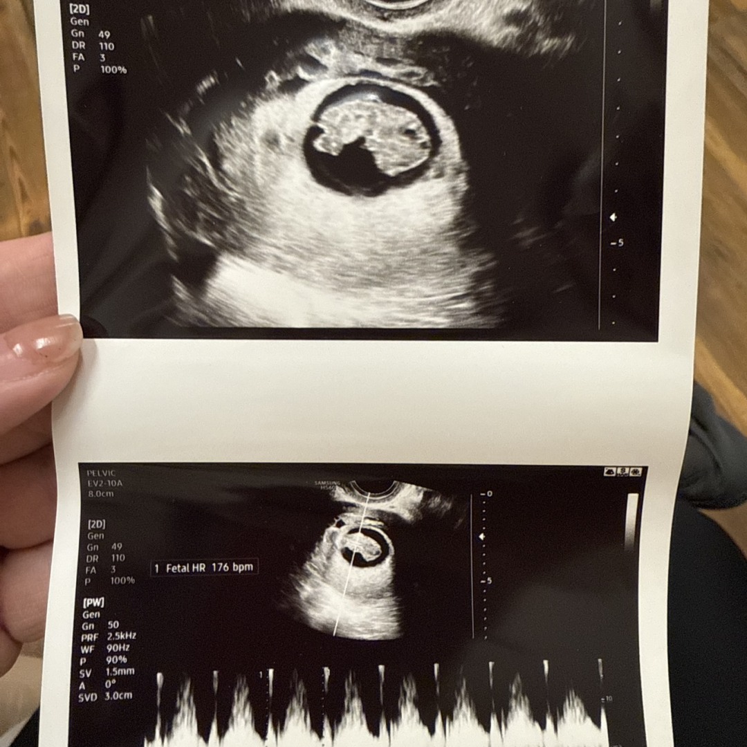 Photo shared by Jennifer for their Babylist baby registry.