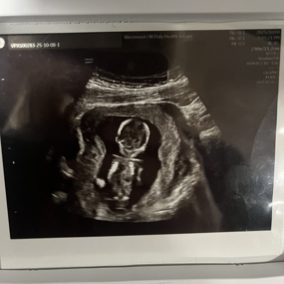 Photo shared by Amber for their Babylist baby registry.