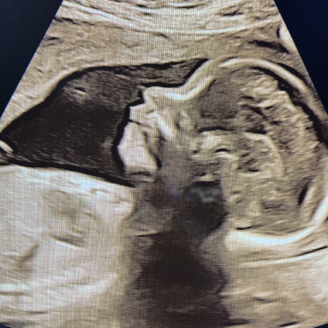 Photo shared by Felisha for their Babylist baby registry.