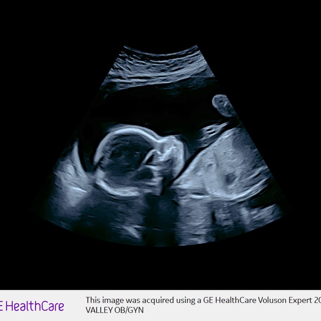 Photo shared by Giselle for their Babylist baby registry.