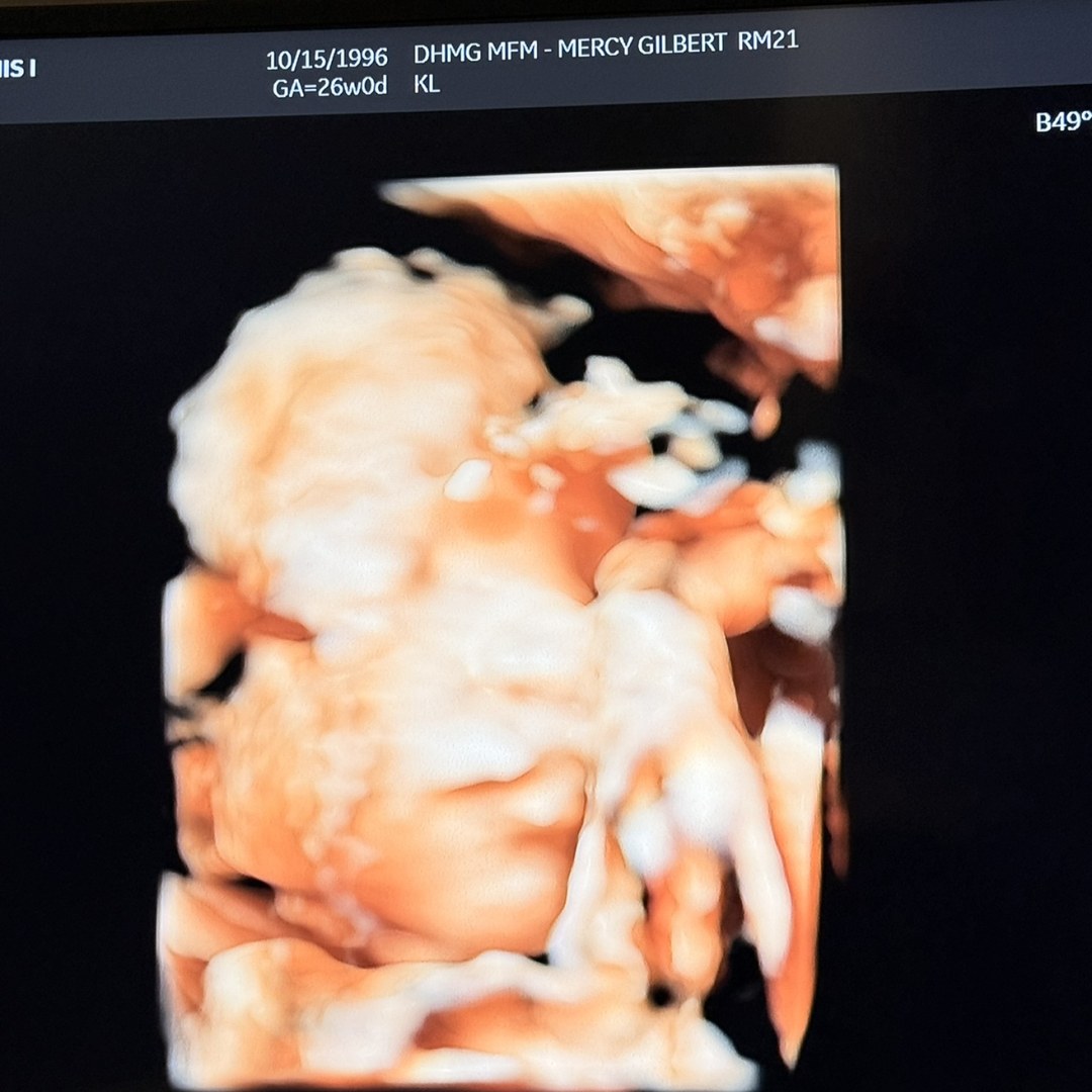 Photo shared by Lennis for their Babylist baby registry.