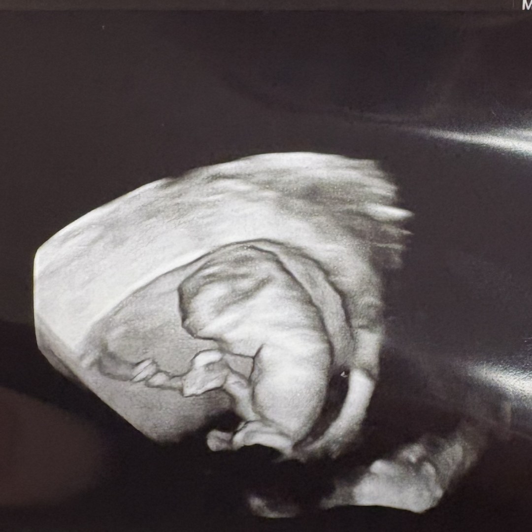 Photo shared by Skye for their Babylist baby registry.