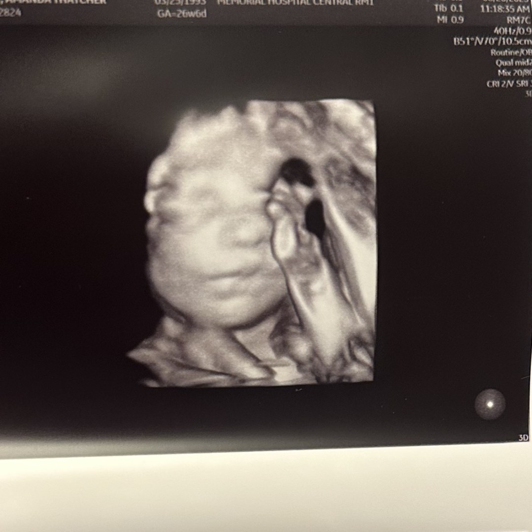 Photo shared by Amanda for their Babylist baby registry.