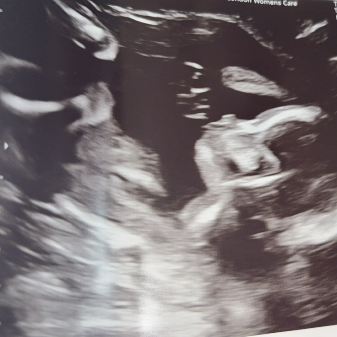 Photo shared by Baylee for their Babylist baby registry.