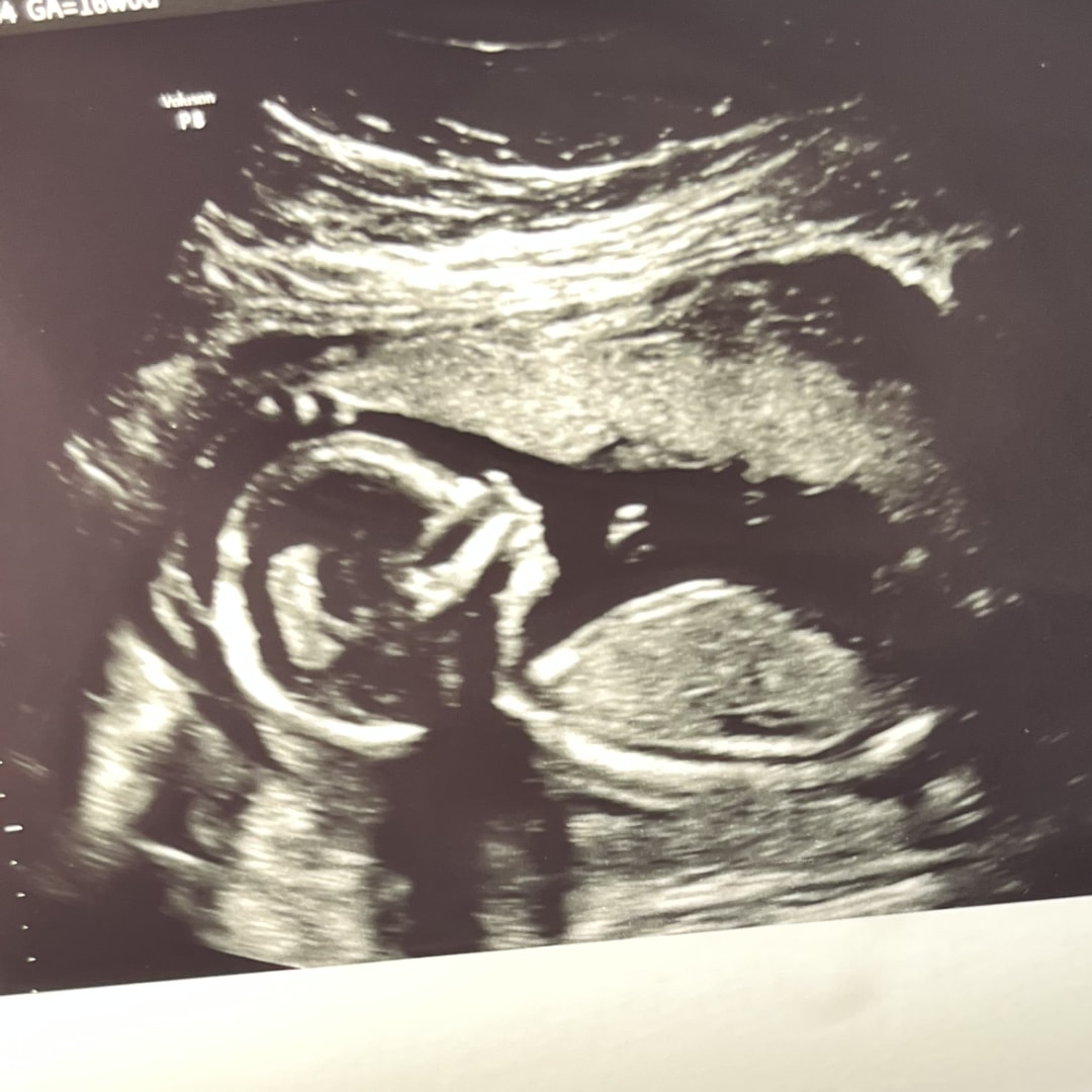 Photo shared by Paige for their Babylist baby registry.