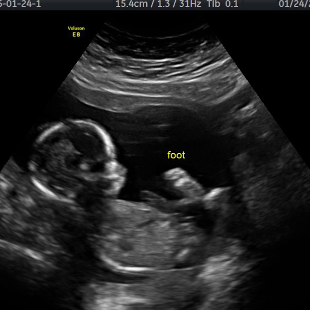 Photo shared by Claudia for their Babylist baby registry.