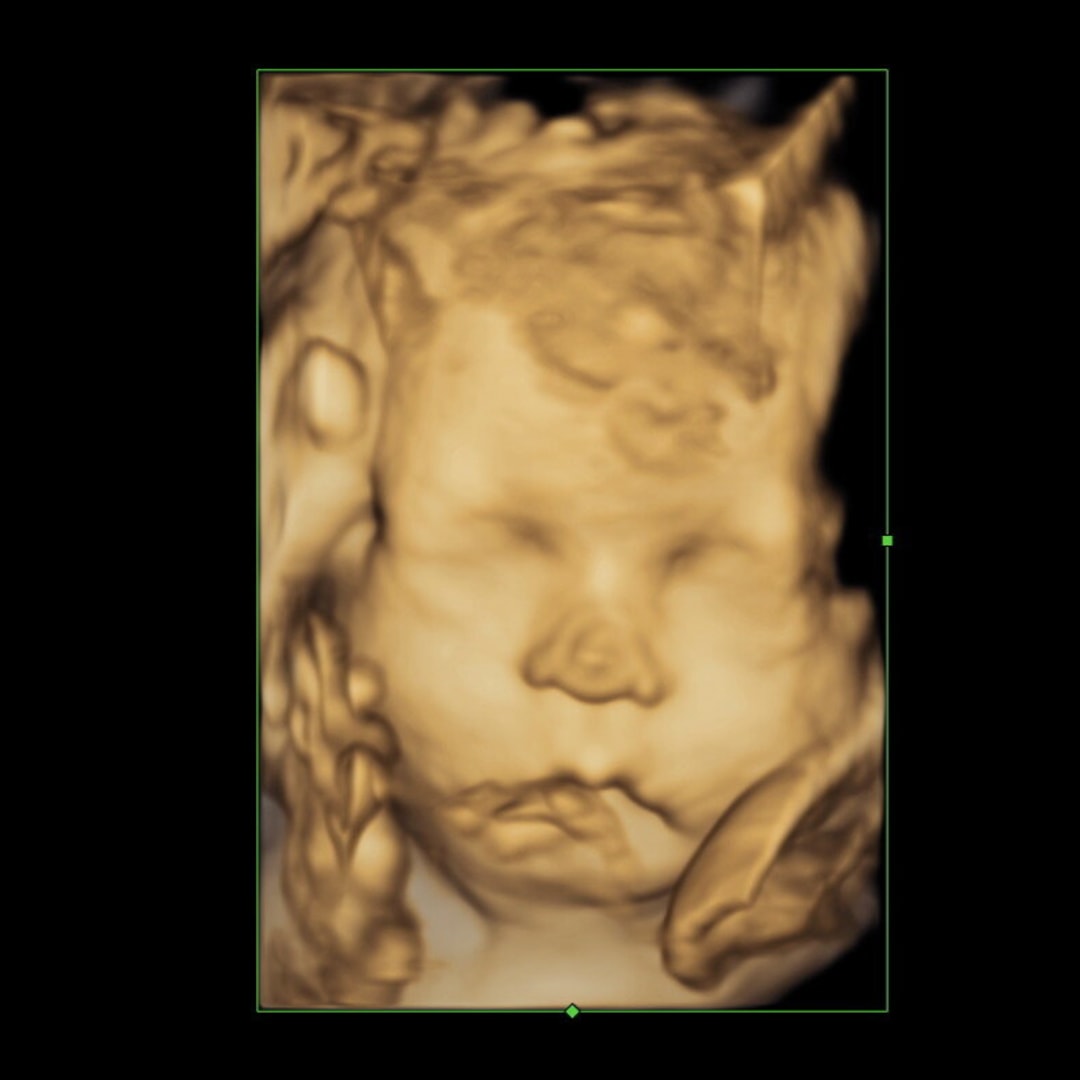 Photo shared by Kimberly for their Babylist baby registry.