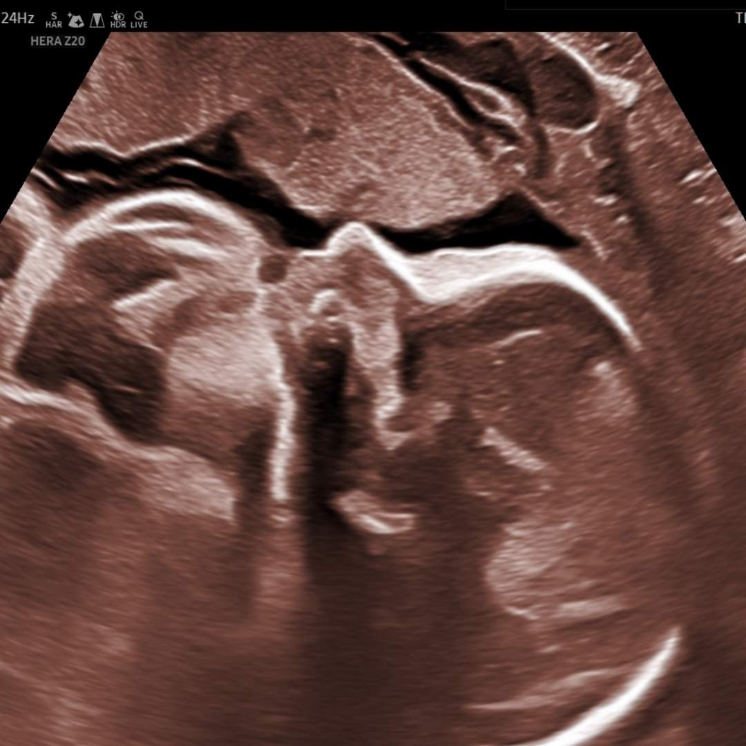 Photo shared by Ashley for their Babylist baby registry.