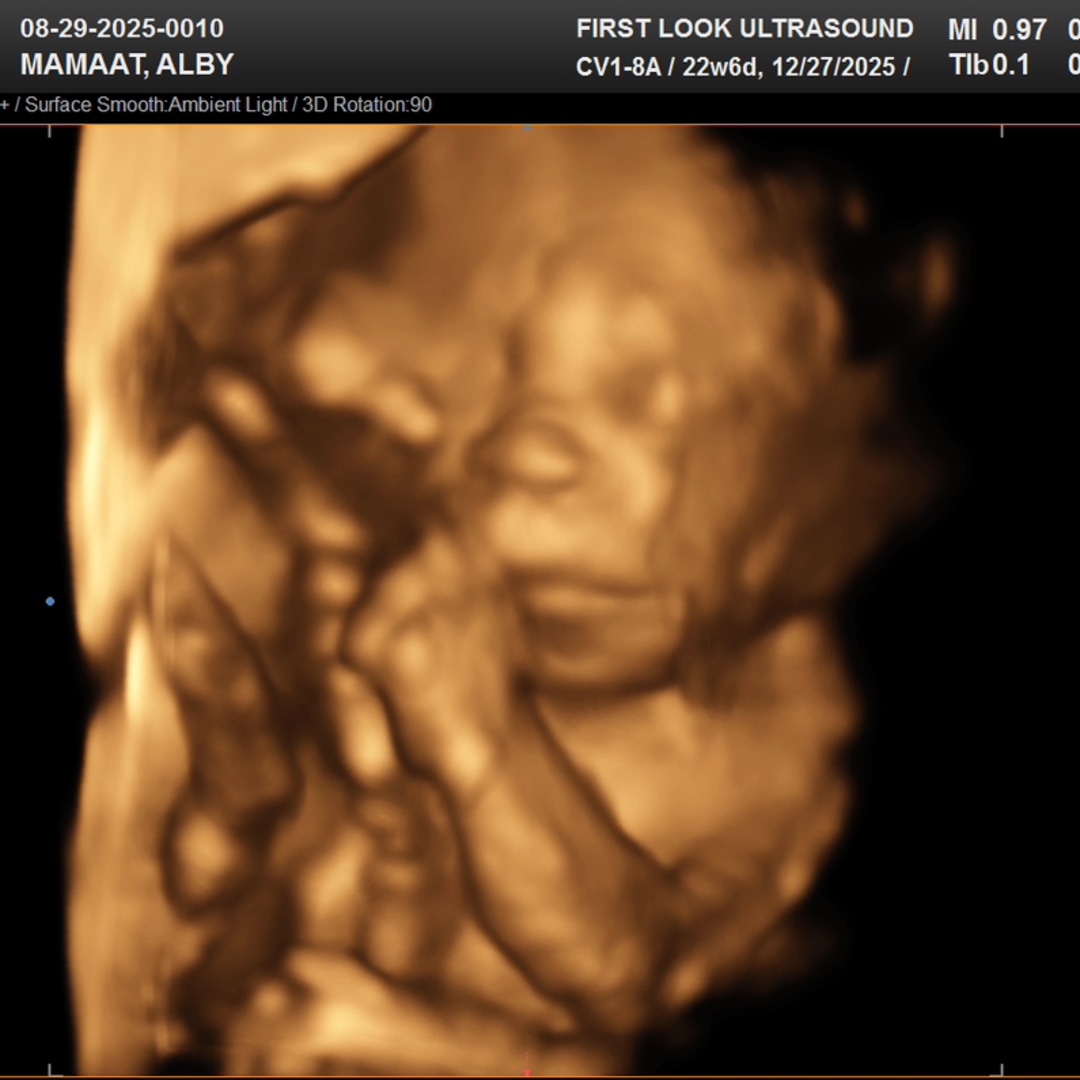 Photo shared by Alby for their Babylist baby registry.