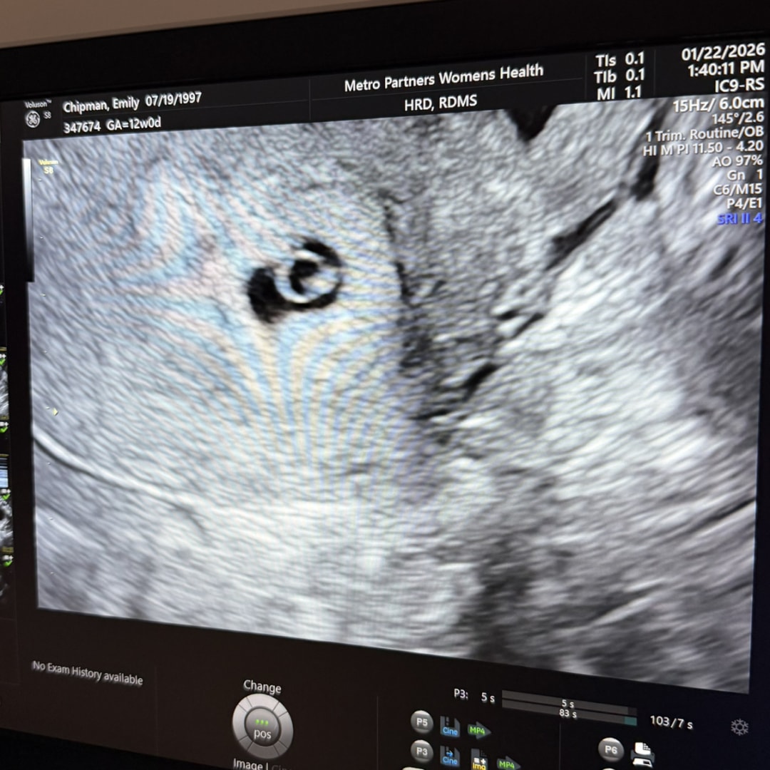 Photo shared by Emily for their Babylist baby registry.