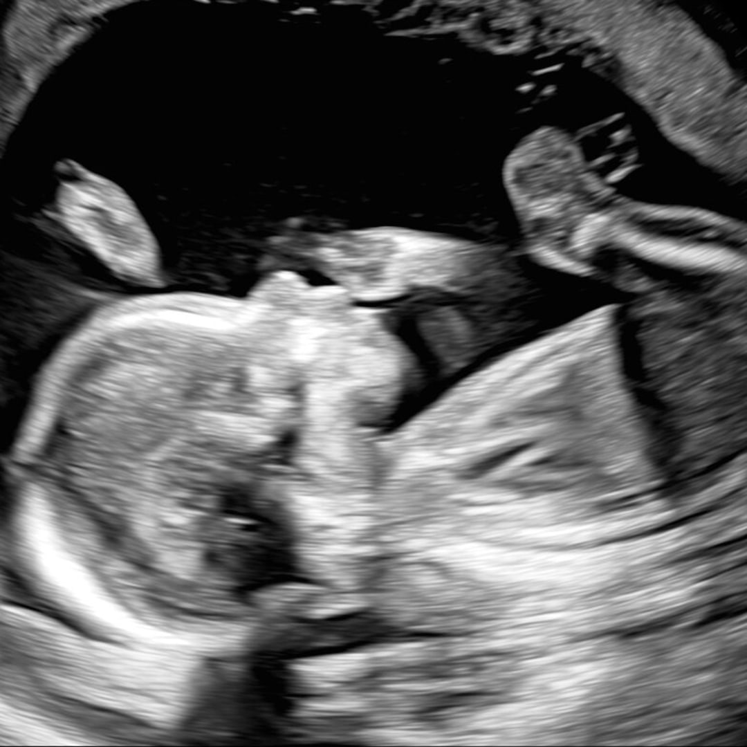 Photo shared by Desera for their Babylist baby registry.