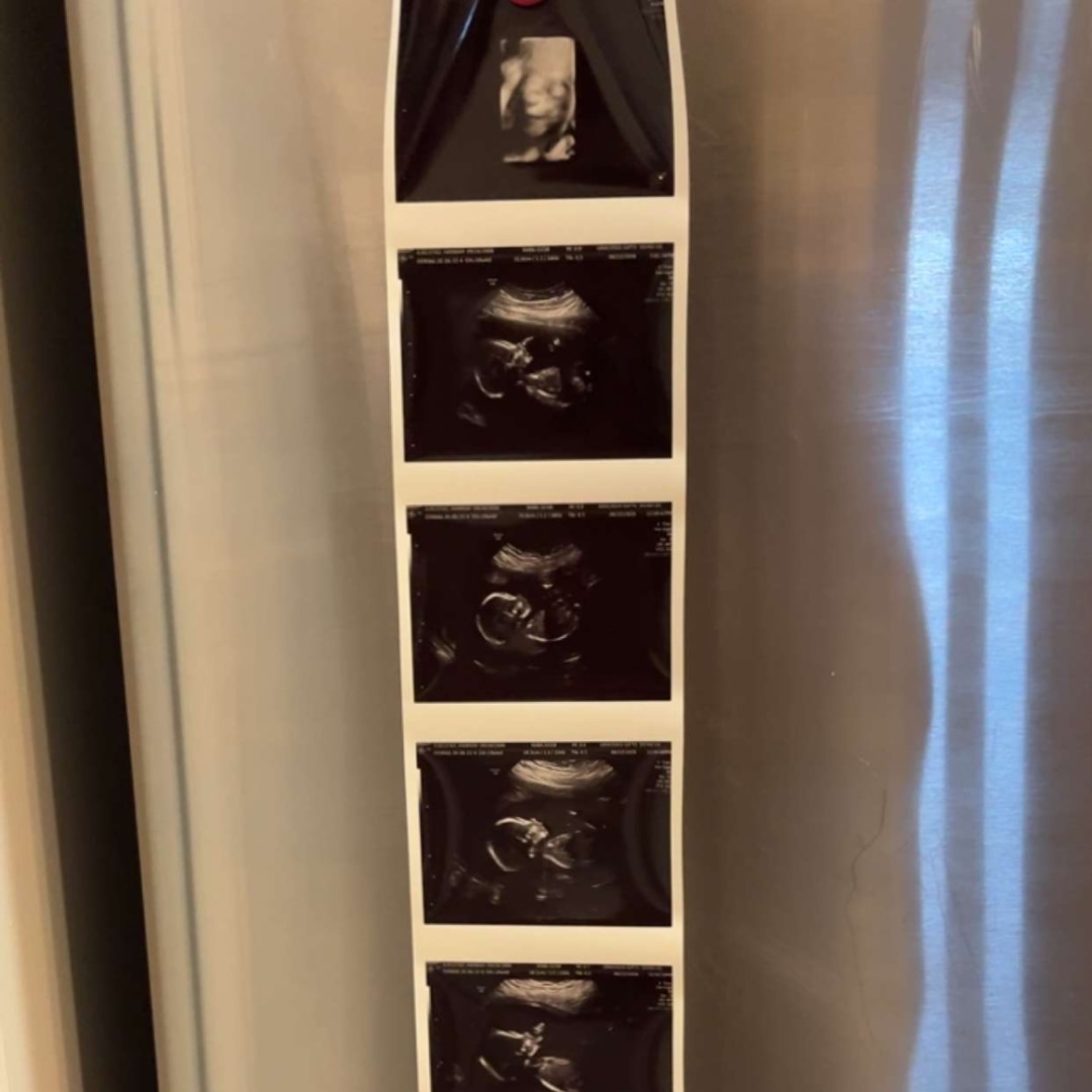 Photo shared by Hannah & Jacob for their Babylist baby registry.