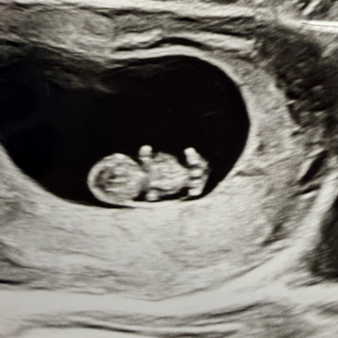 Photo shared by Anastassia for their Babylist baby registry.