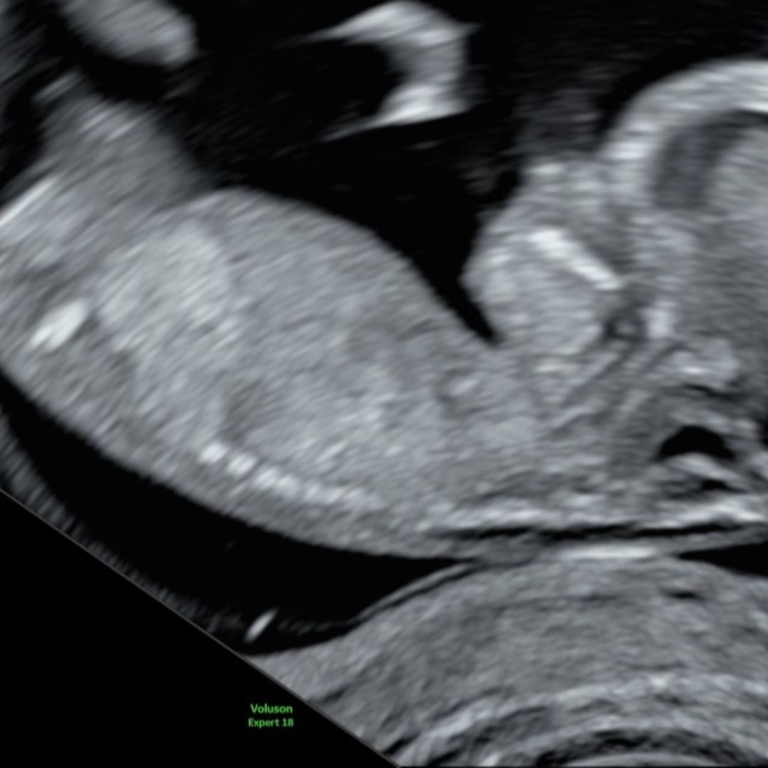 Photo shared by Batya sara&Shaya for their Babylist baby registry.