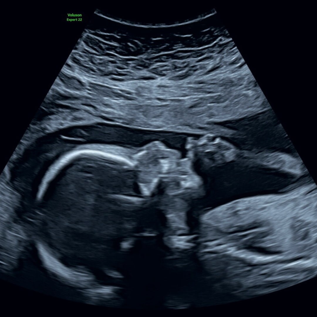 Photo shared by Jackie for their Babylist baby registry.