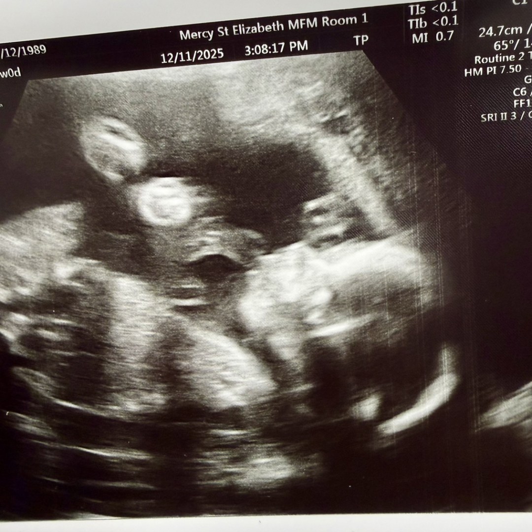 Photo shared by Brooke for their Babylist baby registry.