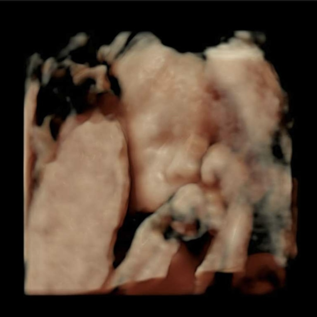 Photo shared by Carson for their Babylist baby registry.