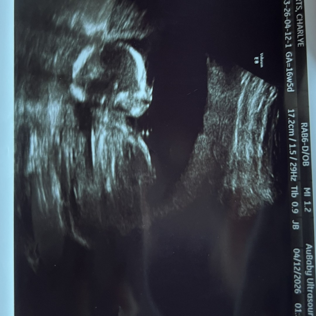 Photo shared by Charlye for their Babylist baby registry.