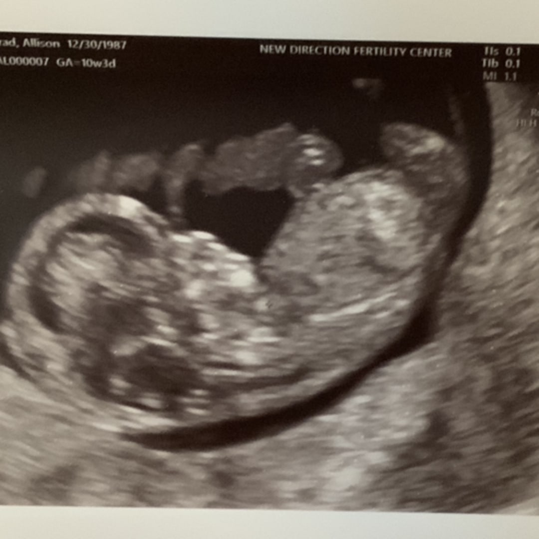 Photo shared by Allison for their Babylist baby registry.
