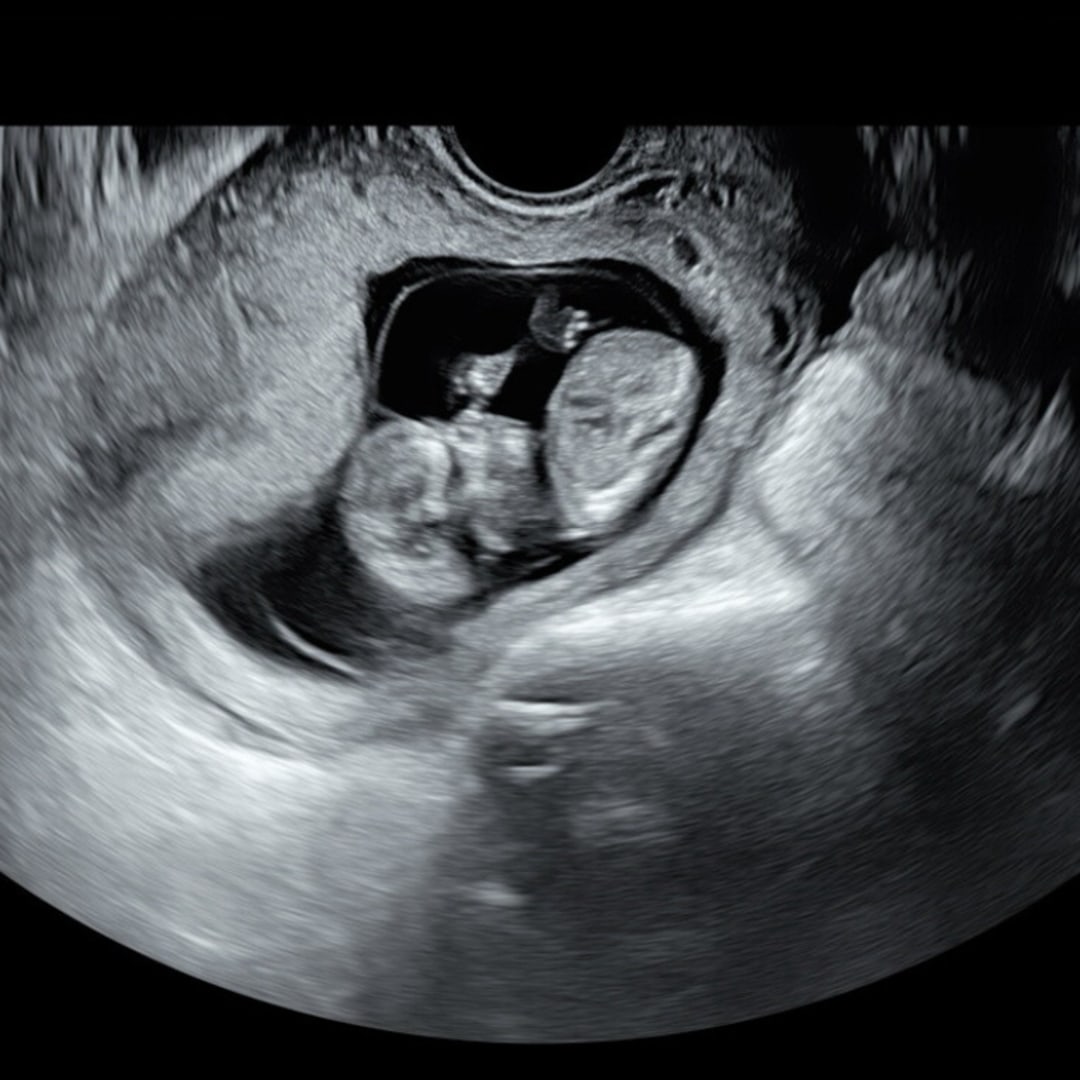 Photo shared by Hannah for their Babylist baby registry.