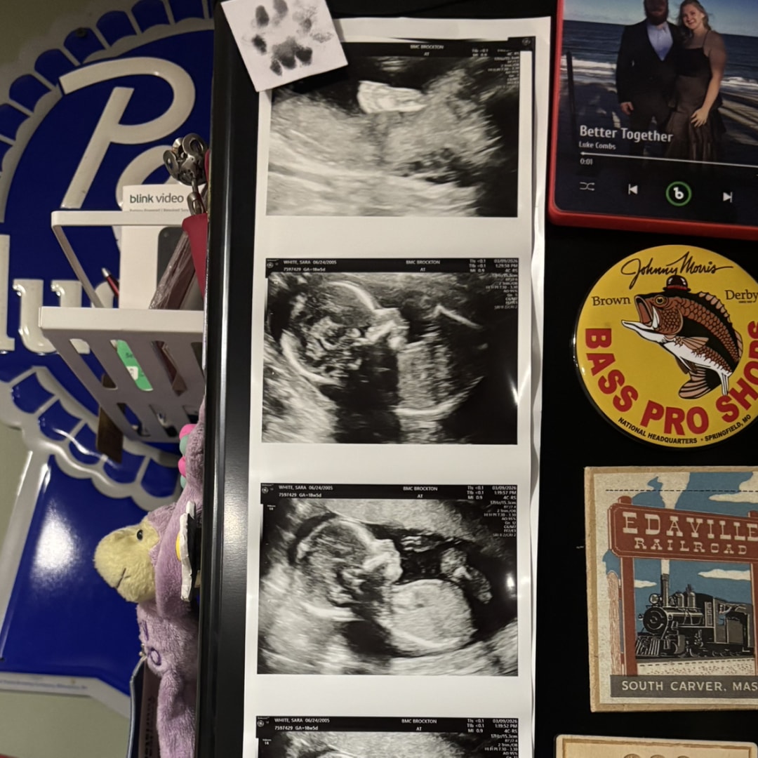 Photo shared by Sara for their Babylist baby registry.