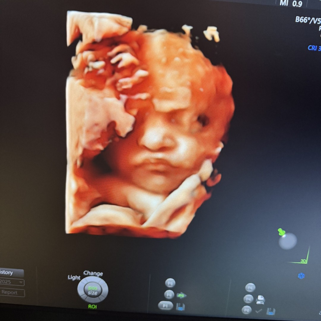 Photo shared by Rosario for their Babylist baby registry.