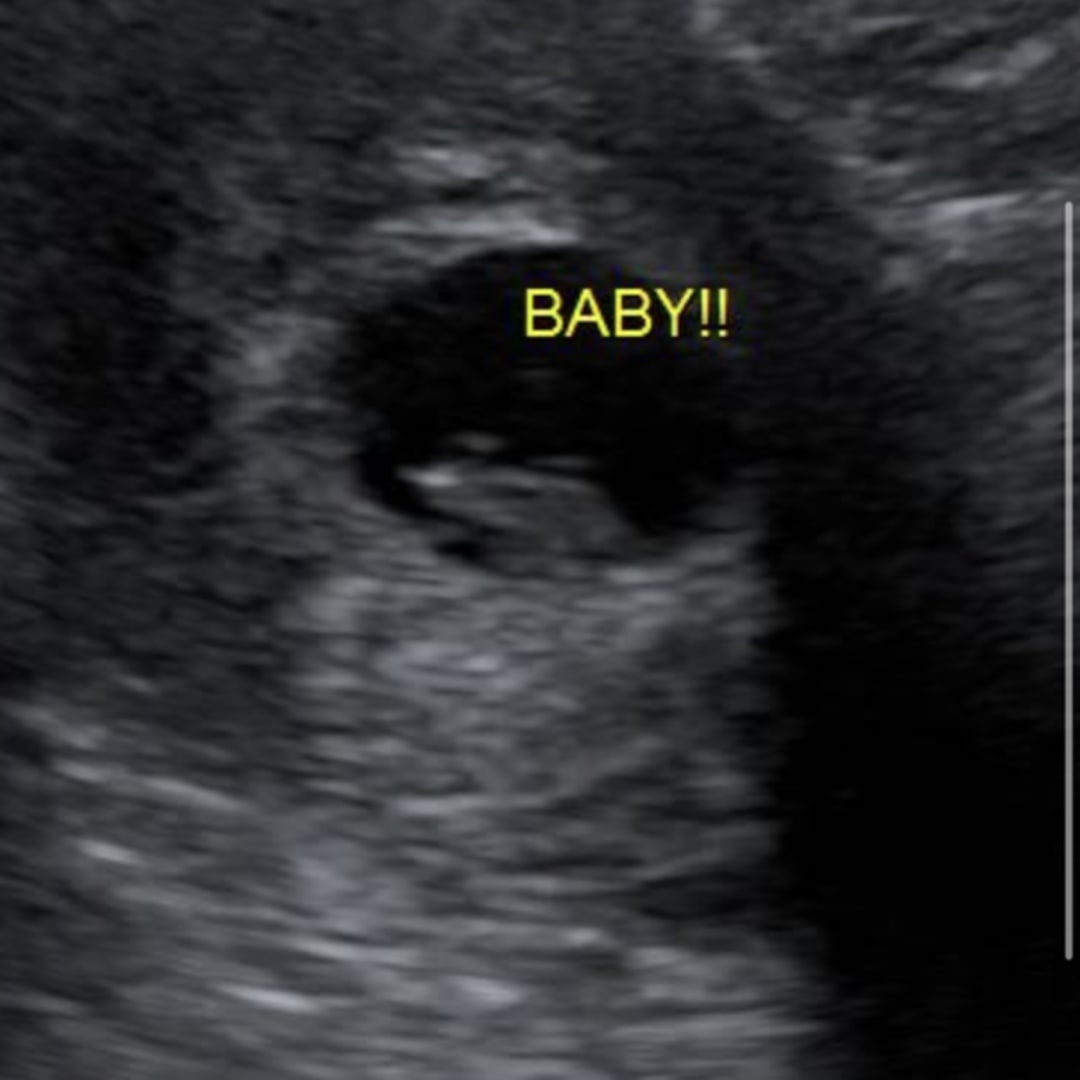 Photo shared by Destiny for their Babylist baby registry.