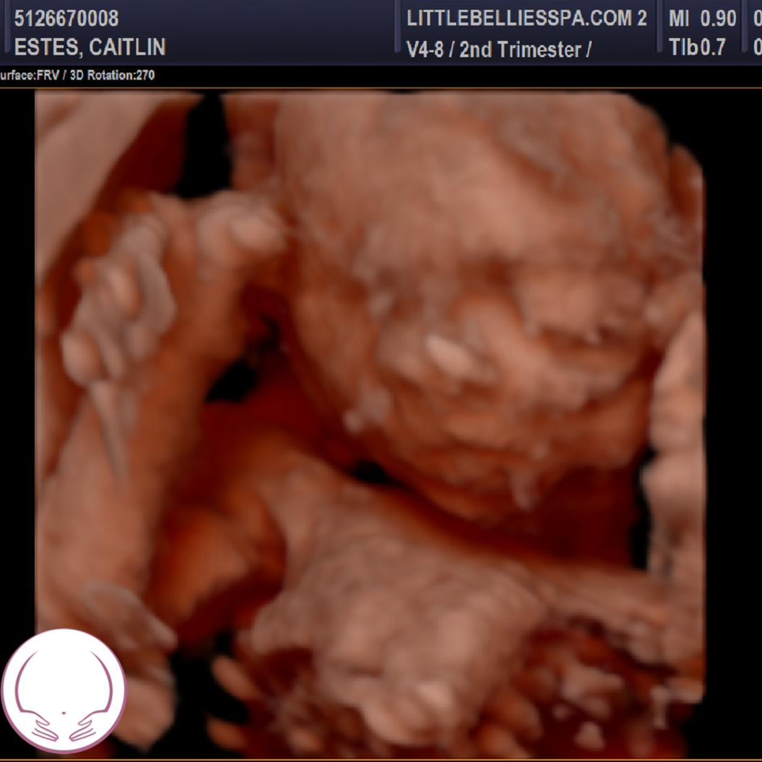 Photo shared by Caitlin for their Babylist baby registry.