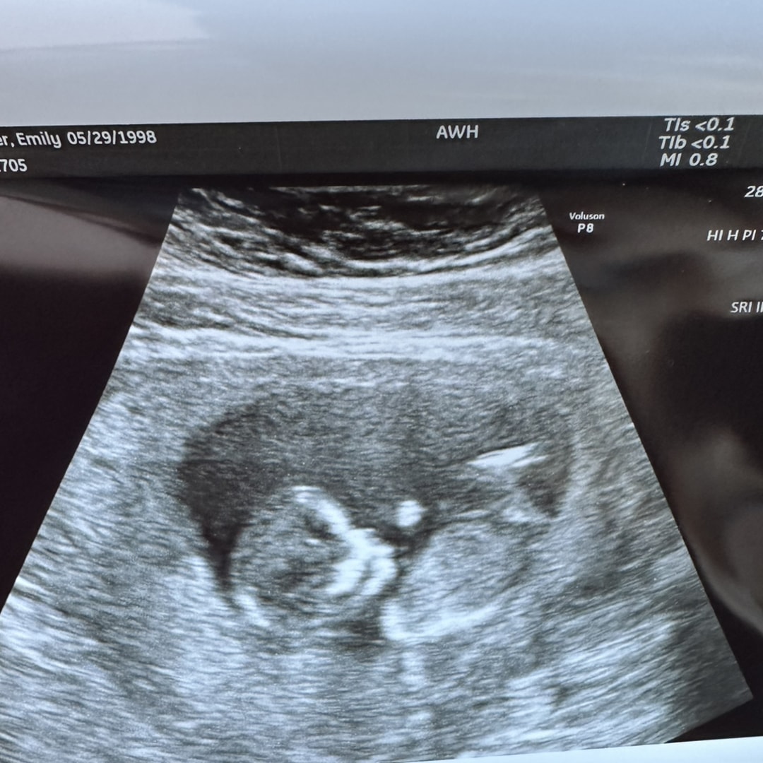 Photo shared by Emily for their Babylist baby registry.