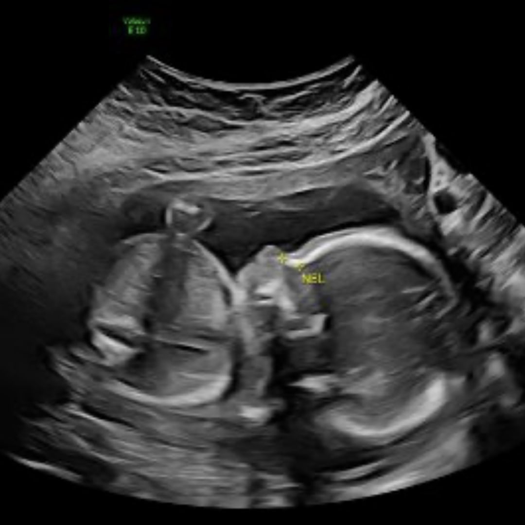 Photo shared by Belle for their Babylist baby registry.