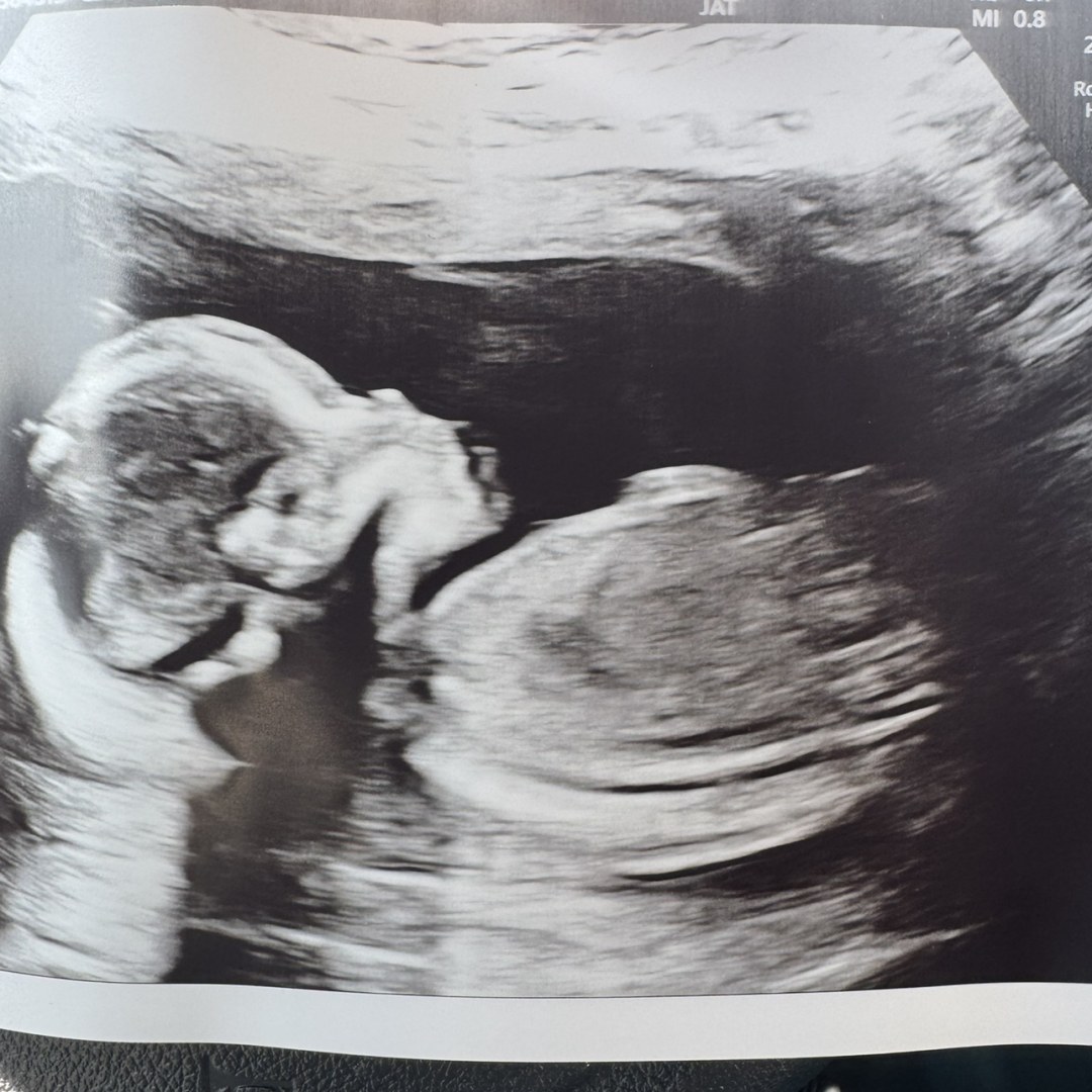 Photo shared by Brittney for their Babylist baby registry.