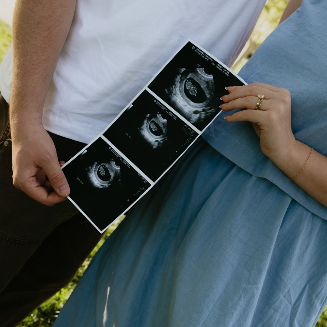Photo shared by Taylor for their Babylist baby registry.